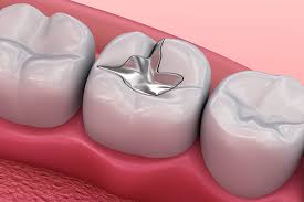 Fillings