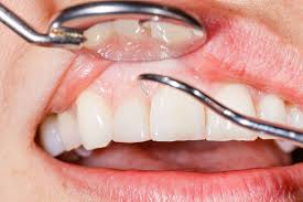 Periodontics