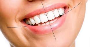 Smile Design